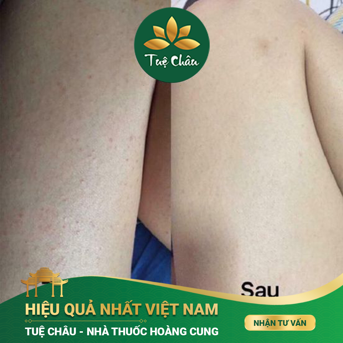 Nguyễn Thị Ngọc